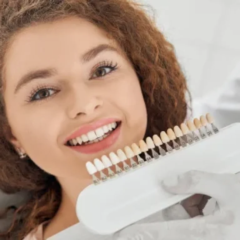 Internal Teeth Whitening